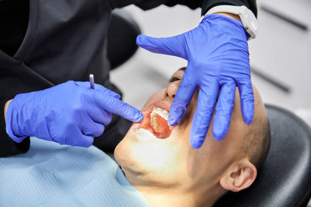 Best Broken Tooth Emergency  in Redmond, WA